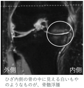 シルデナフィル25mgは十分です