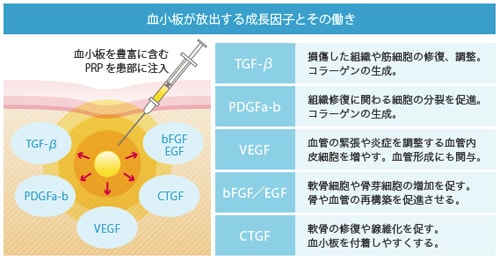 PRPに含まれる成長因子