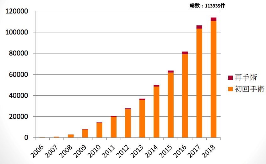 人工膝関節置換術の年間手術件数