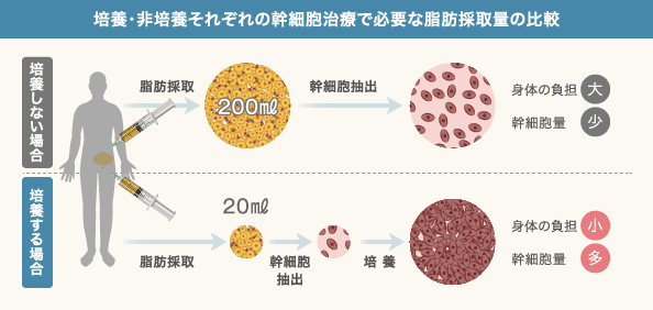 膝の幹細胞治療の流れ