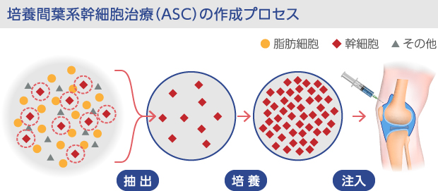 培養間葉系幹細胞の注入プロセス