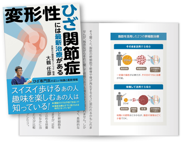 変形性ひざ関節症には最新治療がある