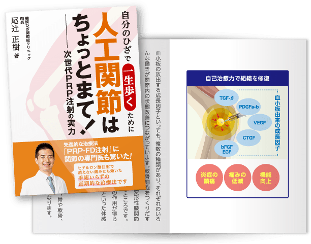 人工関節はちょっとまて！