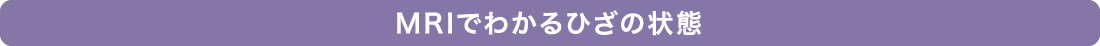 MRIでわかるひざの状態