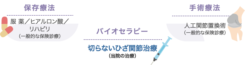 保存療法（服薬／ヒアルロン酸／リハビリ（一般的な保険診療）） | バイオセラピー（切らないひざ関節治療（当院の治療）） | 手術療法（人工関節置換術（一般的な保険診療））