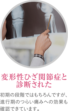 変形性ひざ関節症と診断された 初期の段階ではもちろんですが、進行期のつらい痛みへの効果も確認できています。