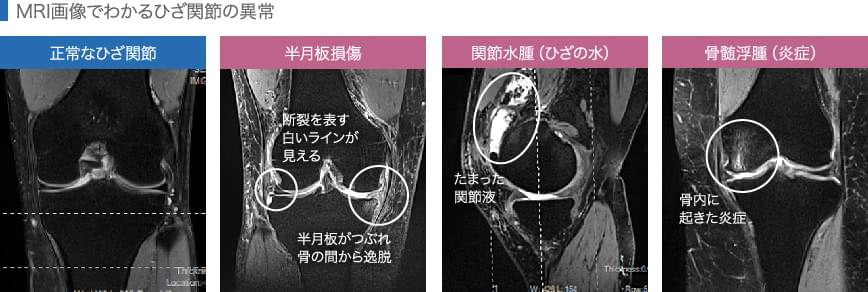 実際の検査画像